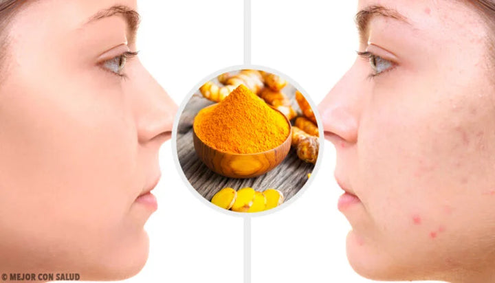 Jabon de Cúrcuma de Miel a solo 2x79.90 soles, ¡Cuida tu Piel con lo Mejor!